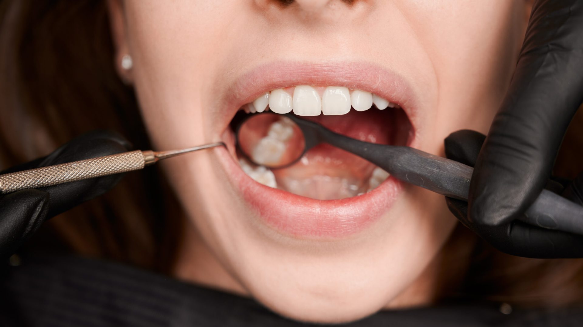 Close-up, cropped snapshot of good looking woman at dentist office during teeth checkup. Dentist examining patient's teeth with mirror and explorer. Oral hygiene concept