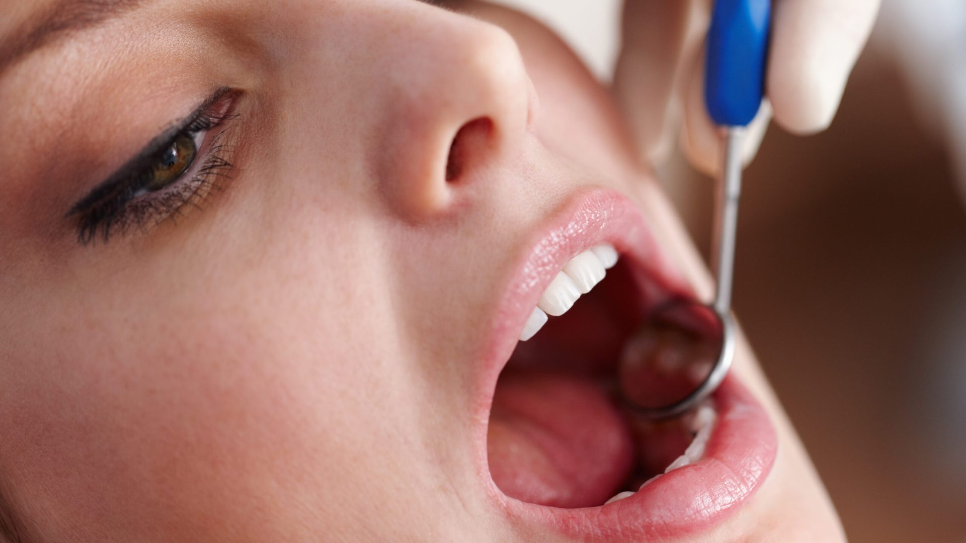 Oral checkup. Closeup of patients open mouth before oral checkup